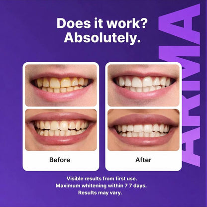 Raptuose Purple Teeth Whitening Strips™
